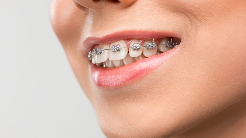 Orthodontics