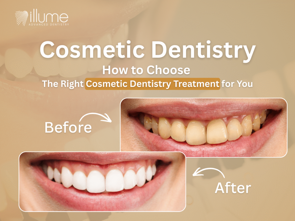 How to Choose the Right Cosmetic Dentistry Treatment for You