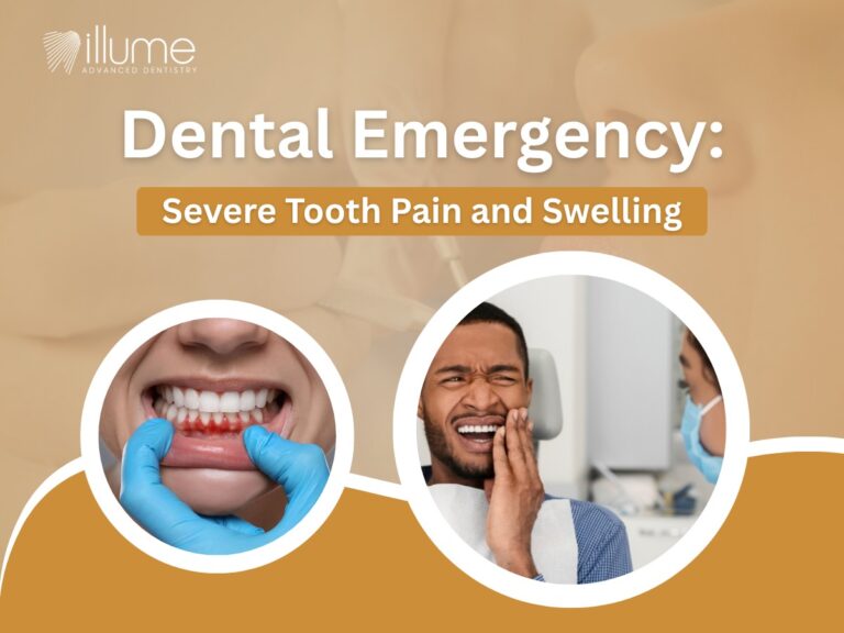 Dental Emergency: Severe Tooth Pain and Swelling