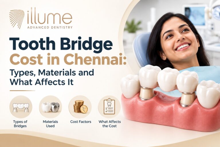 Tooth Bridge Cost in Chennai: Types, Materials and What Affects It